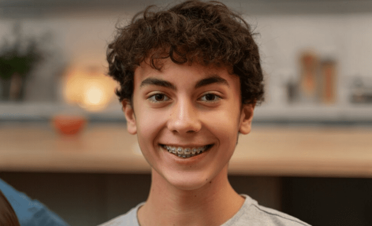 Understanding Damon Braces in Plano, TX