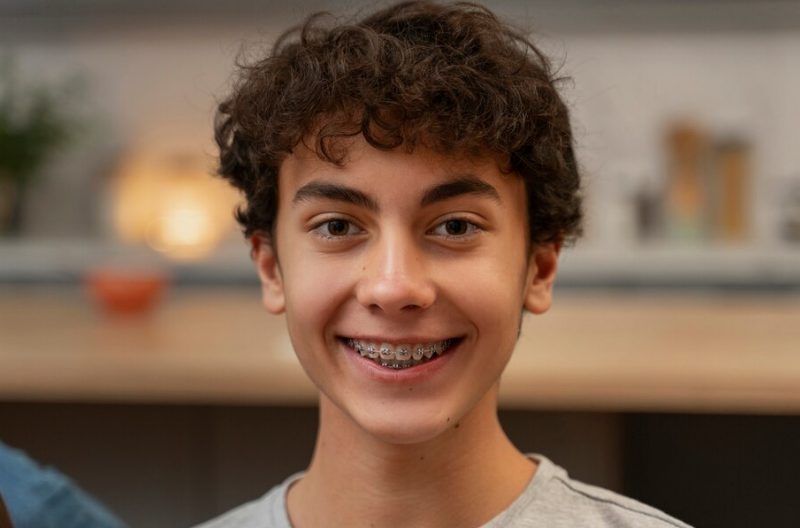 Understanding Damon Braces in Plano, TX