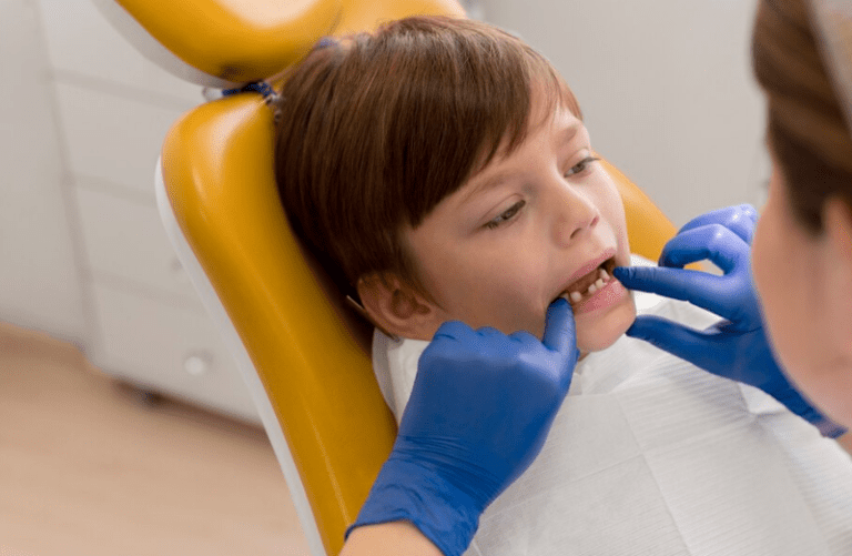 Transform Your Smile with Dental Veneers in Mississauga: A Complete Guide