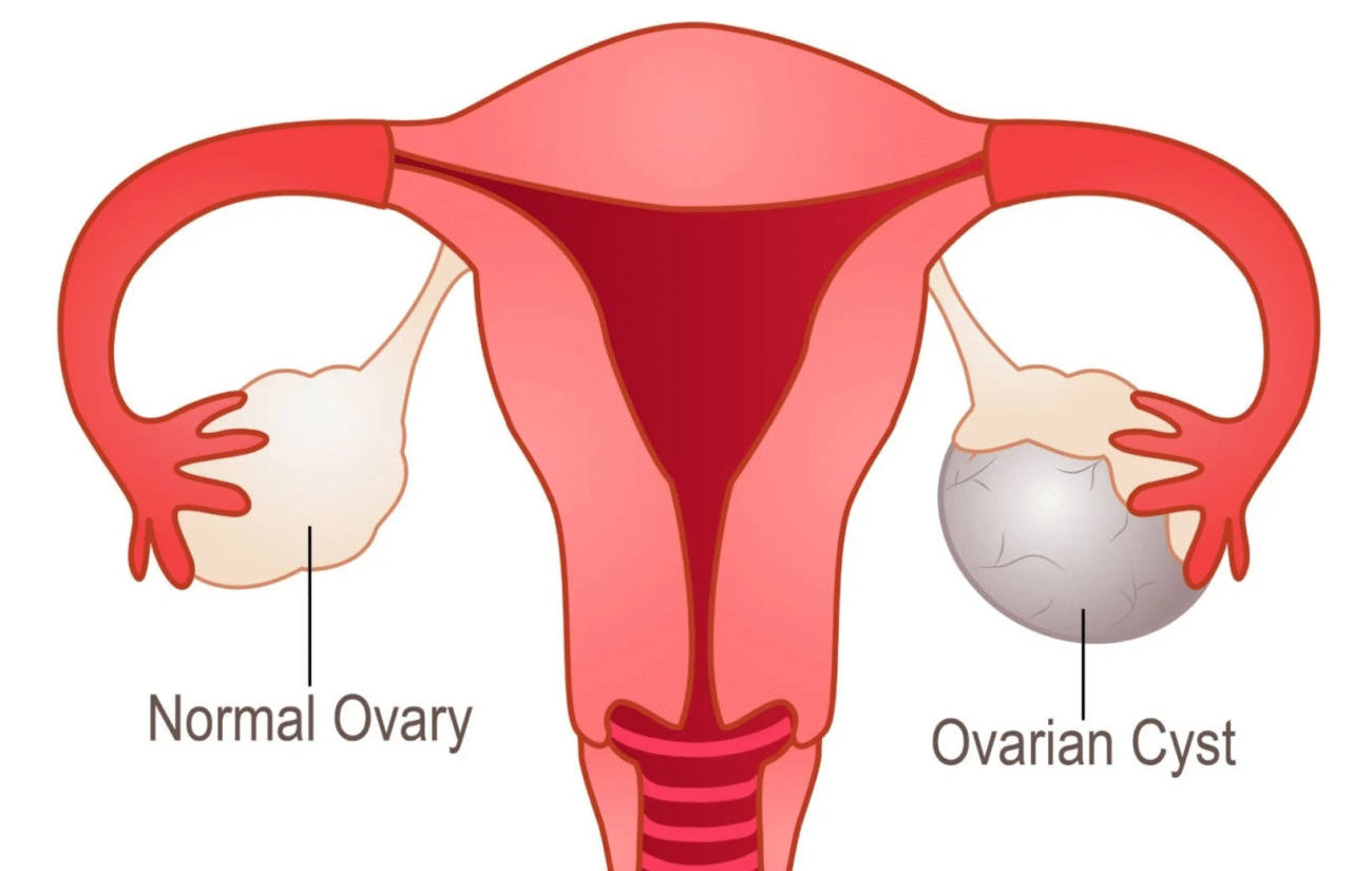 Ovarian Health