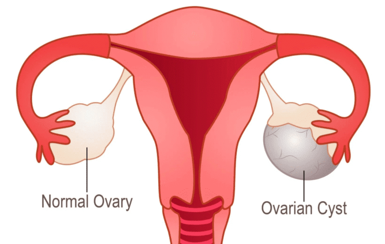 Ovarian Health
