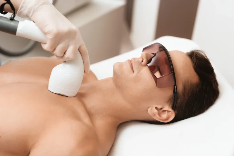 Ditch the Razor: Why Laser Hair Removal Is the Future of Smooth Skin