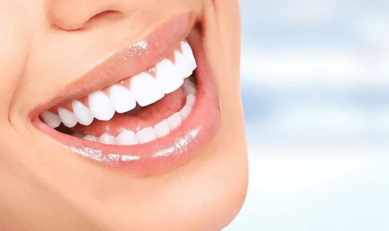 Choosing a Dentist Near Me? Don’t Overlook These Tips for Teeth Whitening and Dental Cleanings