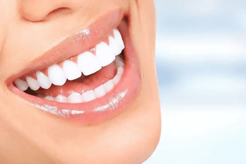 Choosing a Dentist Near Me? Don’t Overlook These Tips for Teeth Whitening and Dental Cleanings