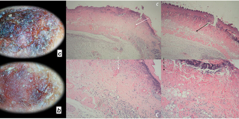 How BPC 157 Supports Connective Tissue Repair?